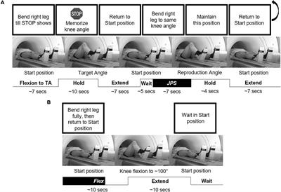 Brain Response to a Knee Proprioception Task Among Persons With Anterior Cruciate Ligament Reconstruction and Controls